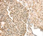 SAMD3 Polyclonal Antibody