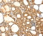 SAMD3 Antibody in Immunohistochemistry (Paraffin) (IHC (P))