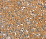 PMAT Polyclonal Antibody