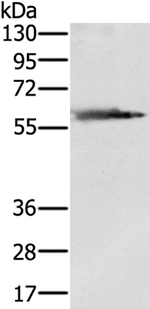 PMAT Antibody in Western Blot (WB)