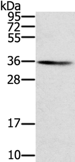 SNX11 Antibody in Western Blot (WB)