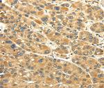 UACA Polyclonal Antibody