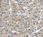 CCDC19 Polyclonal Antibody