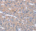 SULF1 Polyclonal Antibody