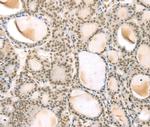 TSPAN13 Antibody in Immunohistochemistry (Paraffin) (IHC (P))