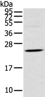 TSPAN13 Antibody in Western Blot (WB)