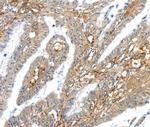 TRIM47 Antibody in Immunohistochemistry (Paraffin) (IHC (P))