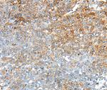 TRIM47 Antibody in Immunohistochemistry (Paraffin) (IHC (P))