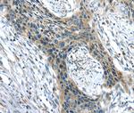 CHRDL1 Polyclonal Antibody