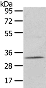 UPP2 Antibody in Western Blot (WB)