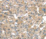 BRWD1 Polyclonal Antibody