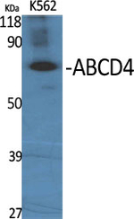 ABCD4 Antibody in Western Blot (WB)