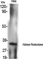 AKR1B1 Antibody in Western Blot (WB)
