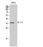 beta-3 Adrenergic Receptor Antibody in Western Blot (WB)