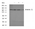 ATXN2L Polyclonal Antibody
