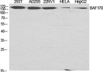 SMARCC2 Polyclonal Antibody