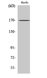 SMARCC2 Antibody in Western Blot (WB)