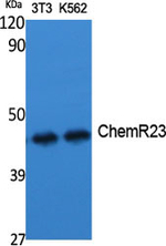 CMKLR1 Polyclonal Antibody