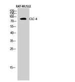 CLCN4 Polyclonal Antibody
