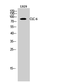 CLCN6 Antibody in Western Blot (WB)