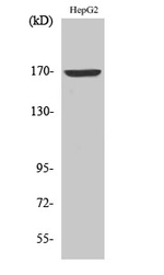 COL4A6 Antibody in Western Blot (WB)