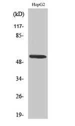 CYP26A1 Antibody in Western Blot (WB)