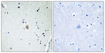 CYP2E1 Antibody in Immunohistochemistry (Paraffin) (IHC (P))