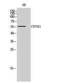 CYP2E1 Antibody in Western Blot (WB)