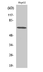 DDX52 Polyclonal Antibody