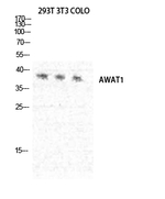AWAT1 Polyclonal Antibody