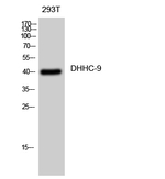 ZDHHC9 Polyclonal Antibody