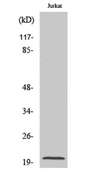 FGF22 Polyclonal Antibody