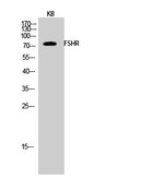 FSHR Antibody in Western Blot (WB)