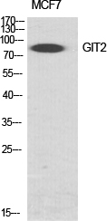 GIT2 Antibody in Western Blot (WB)
