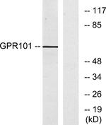 GPR101 Antibody in Western Blot (WB)