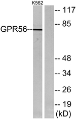 GPR56 Antibody in Western Blot (WB)