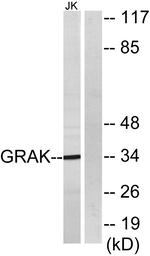 Granzyme K Antibody in Western Blot (WB)