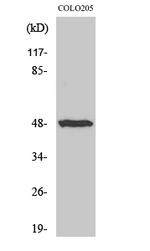 IL13RA1 Polyclonal Antibody