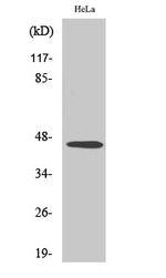 INHBB Polyclonal Antibody