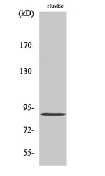 PNPLA8 Polyclonal Antibody