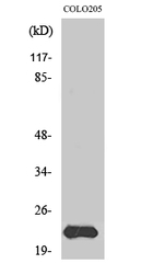 MRPL40 Antibody in Western Blot (WB)