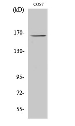 MYOM2 Antibody in Western Blot (WB)