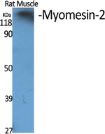 MYOM2 Polyclonal Antibody