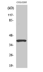SERPINB9 Polyclonal Antibody