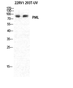 PML Antibody in Western Blot (WB)