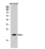 JM4 Antibody in Western Blot (WB)