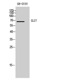 SLU7 Antibody in Western Blot (WB)