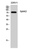 SPHK2 Polyclonal Antibody