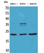 FGF12 Polyclonal Antibody