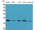FGF20 Antibody in Western Blot (WB)
